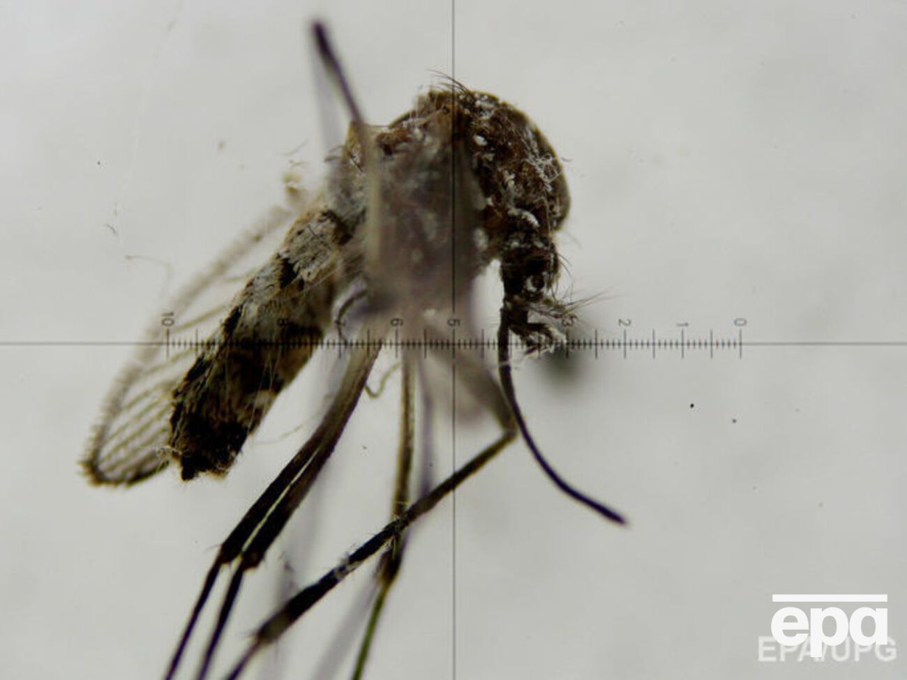 В России зафиксировано шесть случаев заражения вирусом Зика