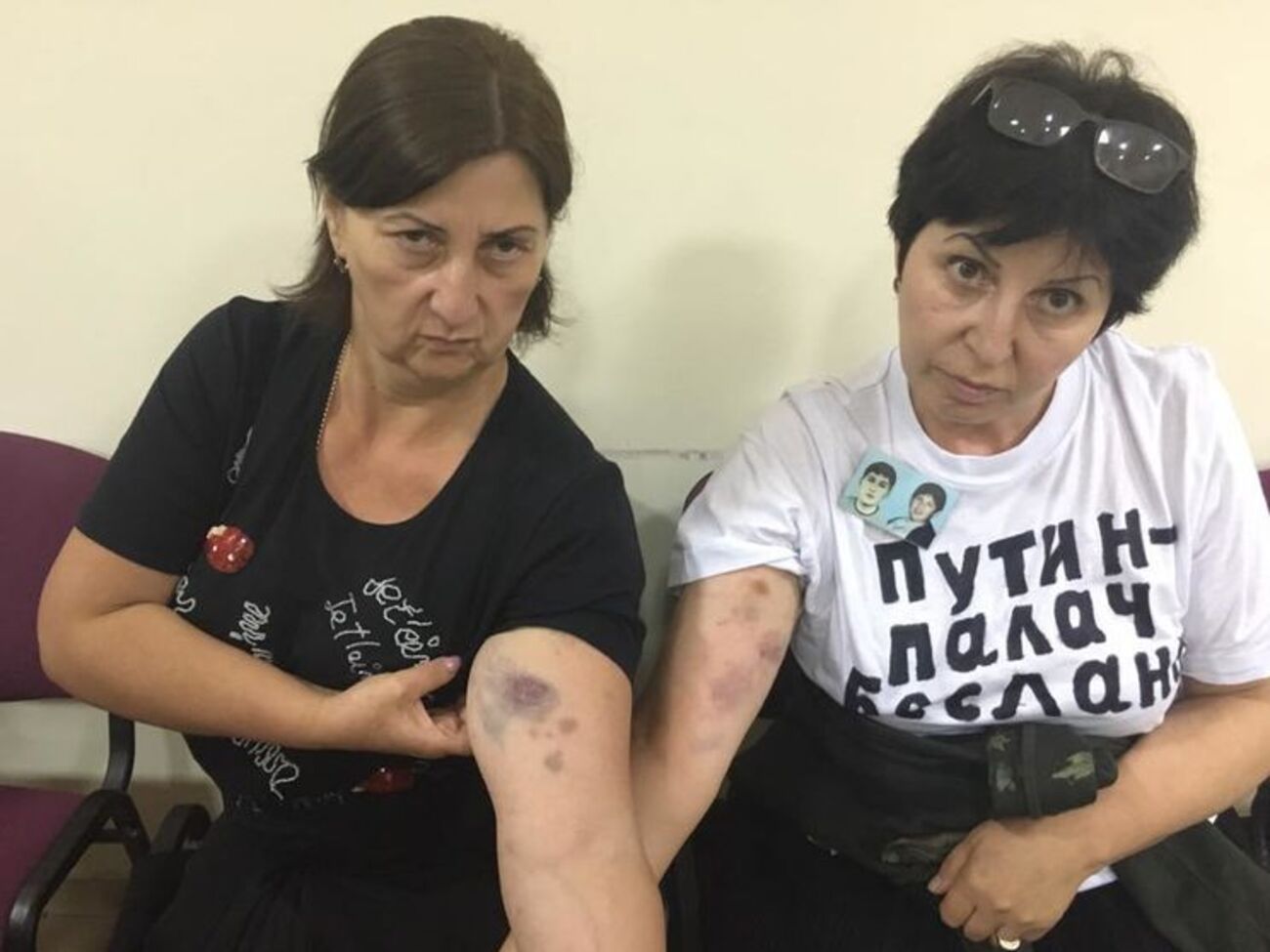 Бабченко: От этого осознания глубины нравственного распада общества волосы встают дыбом