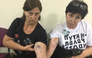 Бабченко: От этого осознания глубины нравственного распада общества волосы встают дыбом