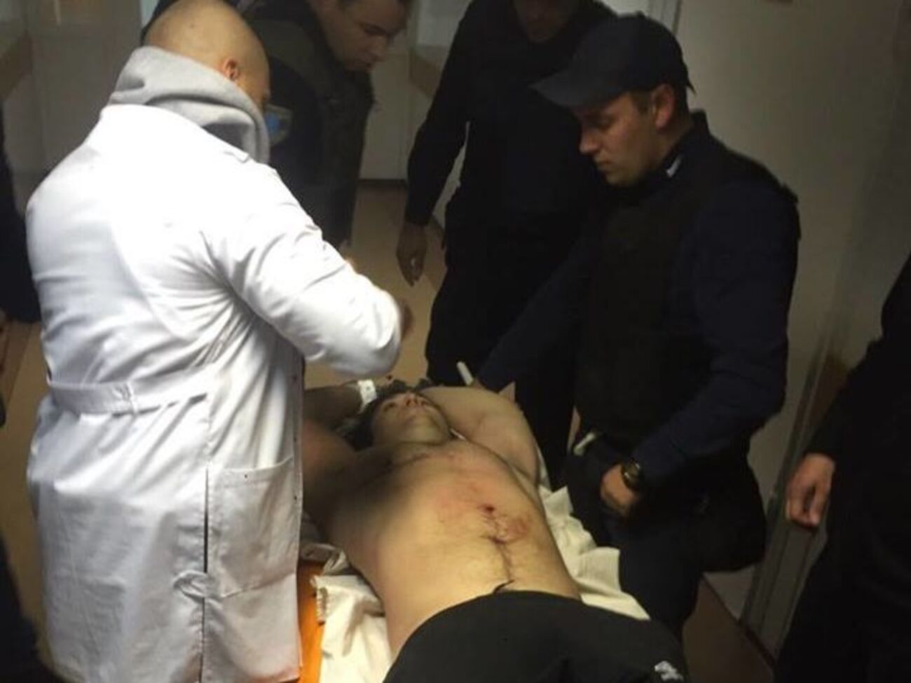 Аваков: Подозреваемого оперируют в одной из больниц Днепра