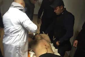 Аваков: Подозреваемого оперируют в одной из больниц Днепра