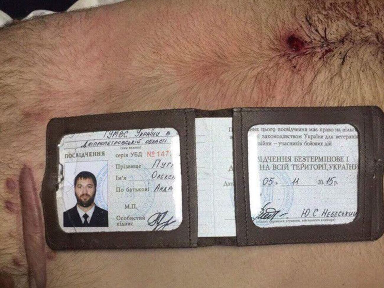 Бутусов:&nbsp;Пугачев в реанимации, если бы он не пошел в больницу, он бы уже был мертв