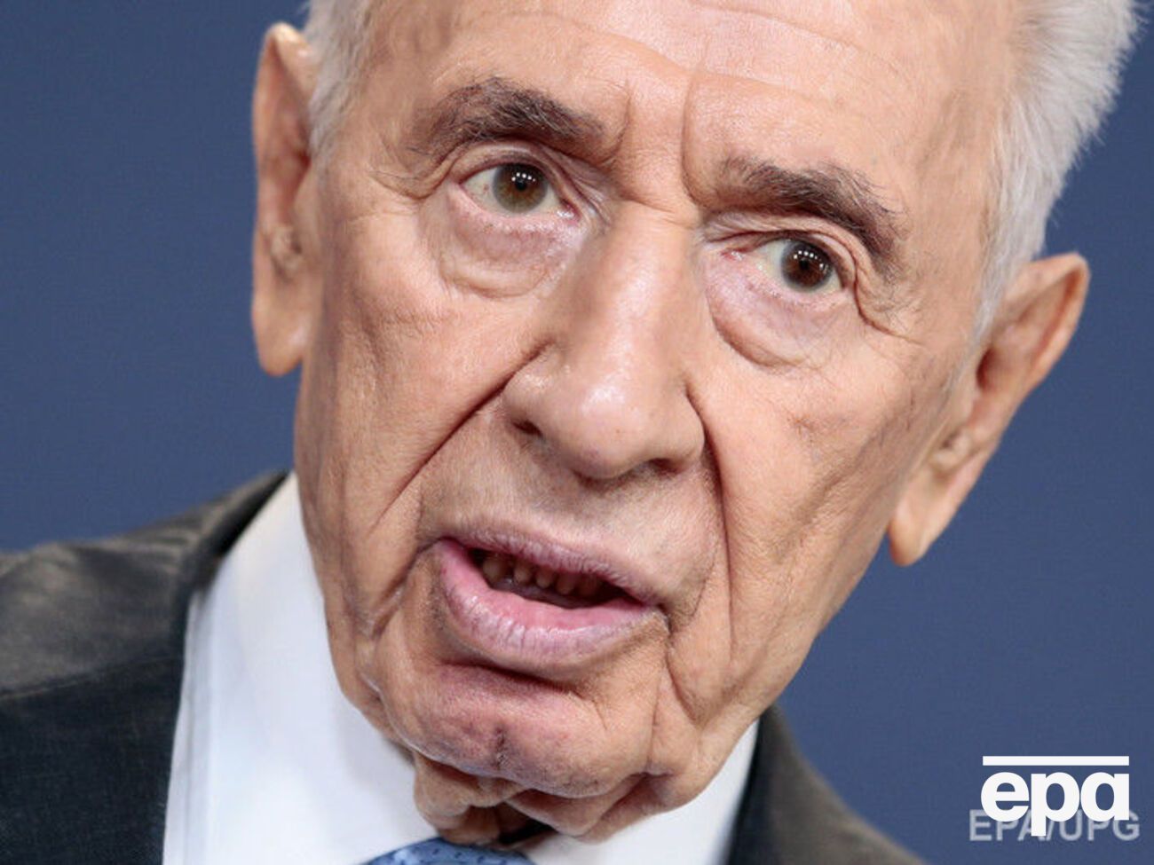 Перес попал в больницу после инсульта