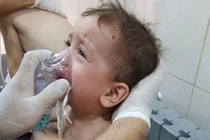 Часто дети умирают из-за отсутствия у врачей необходимого оборудования для оказания помощи