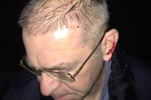 Пашинский продемонстрировал след от удара бутылкой по голове