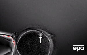 Эксперименты с эмбрионами вызывают этические споры