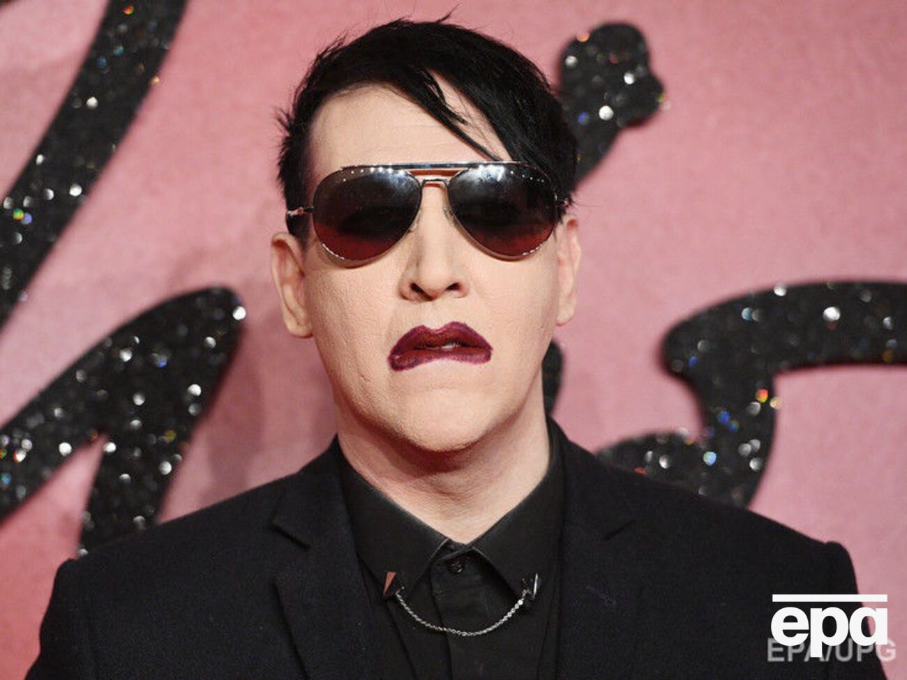 После инцидента Мэнсон попал в больницу