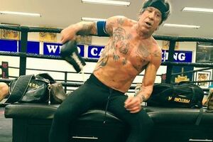 Рурк: Моменти після операції із доктором Діром. Тепер я "знову красунчик"