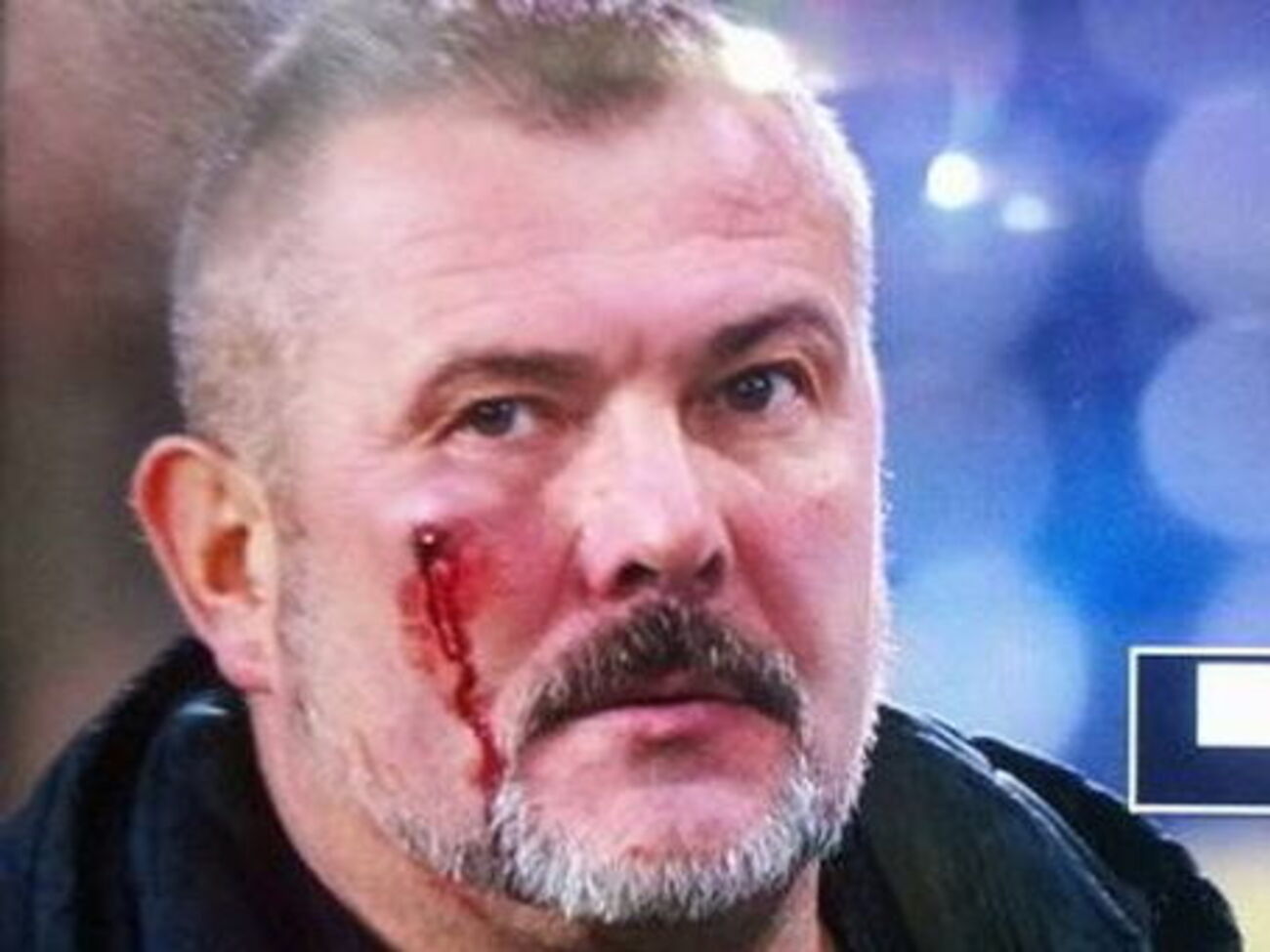 Береза після бійки