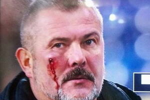 Береза після бійки