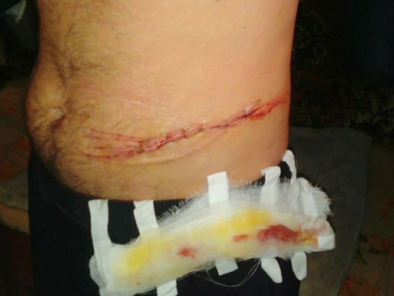 Музычук: Заключенный травмировал себя одноразовым станком