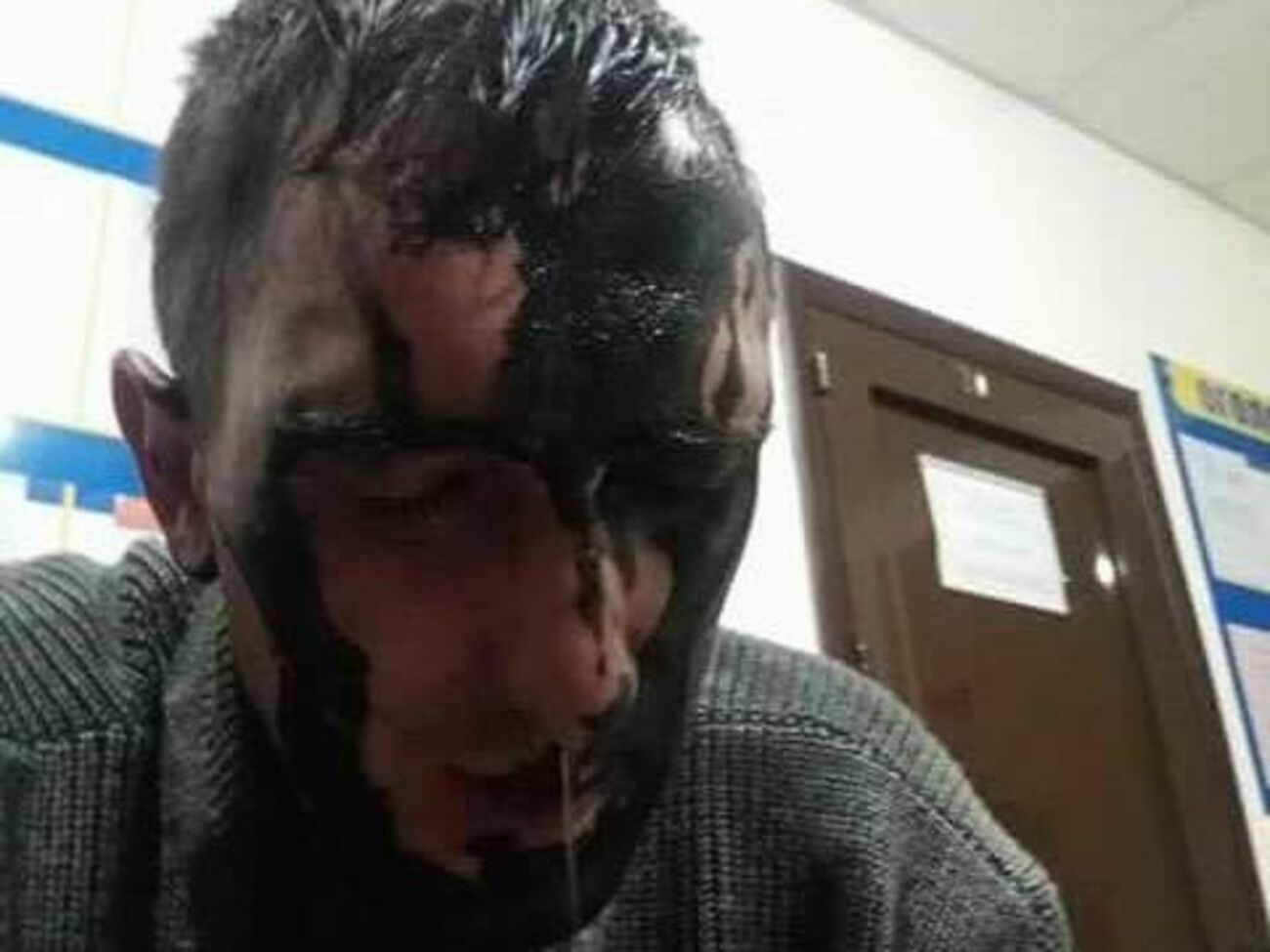 Сообщается, что пытавшийся совершить акт вандализма мужчина "споткнулся и упал"
