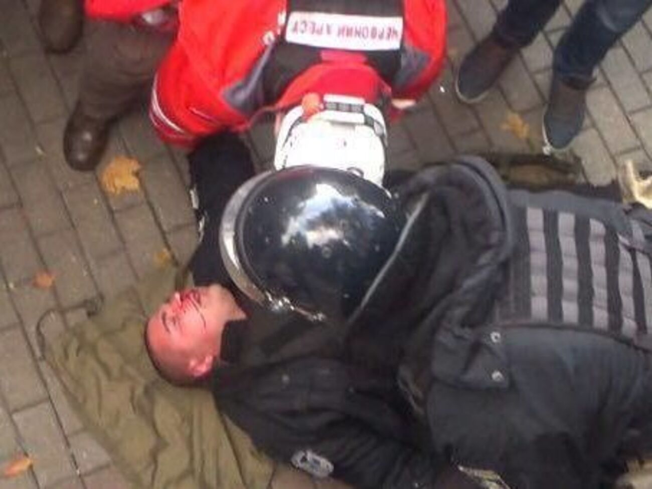 У избитого полицейского диагностировали черепно-мозговую травму