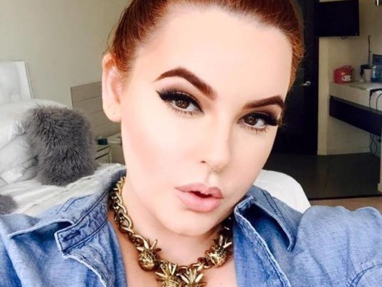 Голлідей: Хочу сказати, що навіть у супермоделей є гнійники. Гормони &ndash;&nbsp;це вбивці