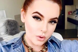 Голлідей: Хочу сказати, що навіть у супермоделей є гнійники. Гормони – це вбивці