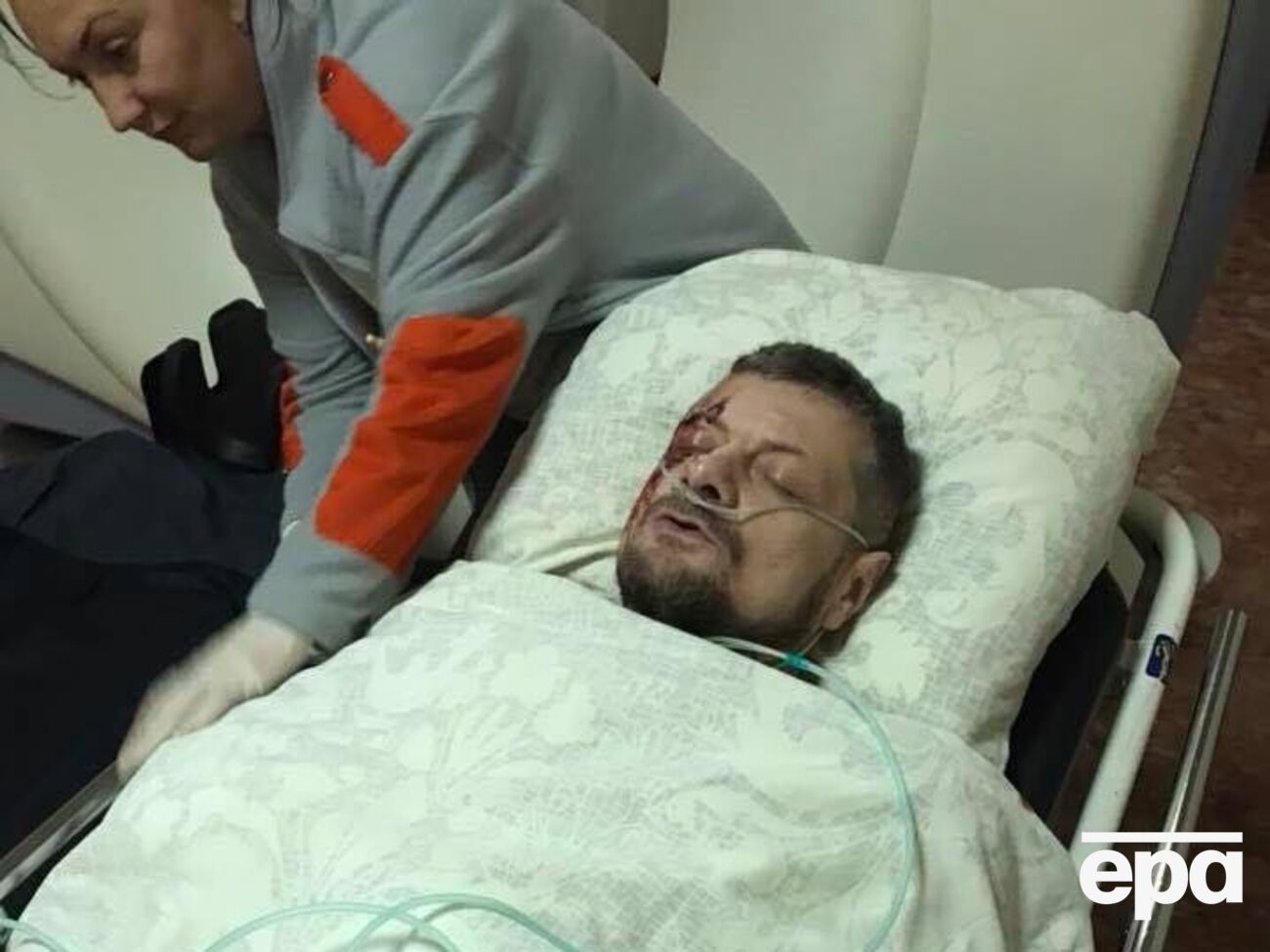 В результате взрыва ранение получил нардеп Мосийчук