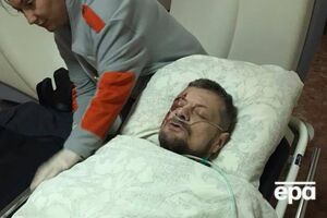 Унаслідок вибуху поранення дістав нардеп Мосійчук