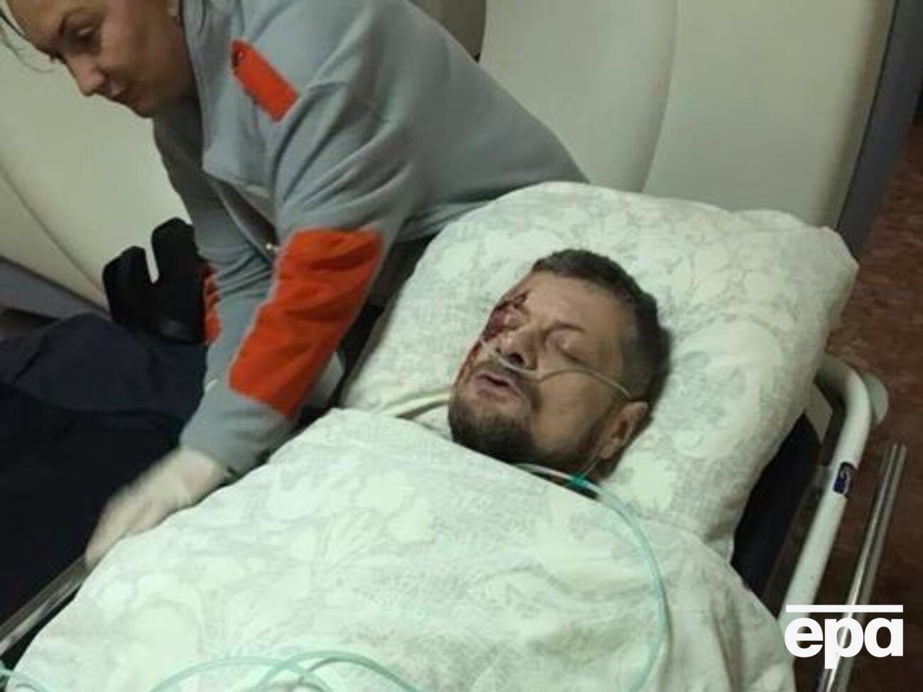 Мосийчук получил осколочные ранения в результате взрыва в Киеве