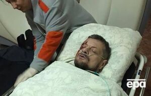 Мосийчук получил осколочные ранения в результате взрыва в Киеве