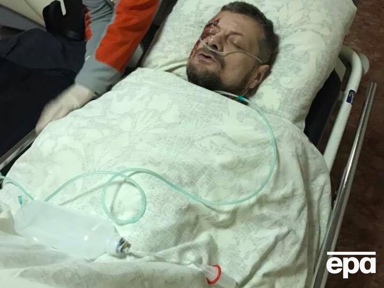 Якщо стан Мосійчука буде стабільним, його сьогодні зможуть перевести з реанімації до загальної палати