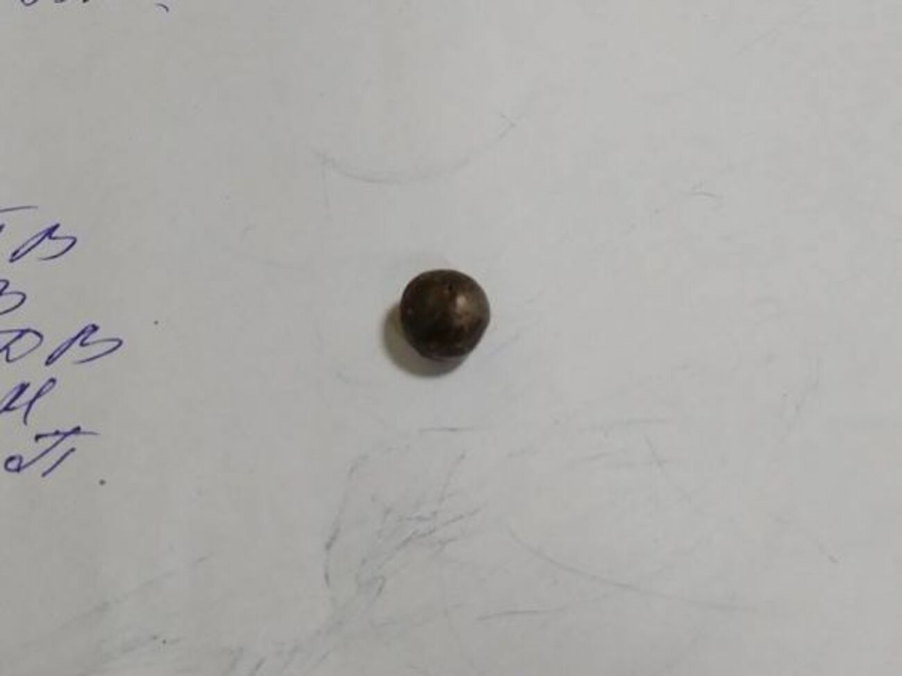 В мозг Тарасенко на 4 см проник металлический шарик