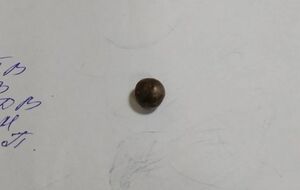 В мозг Тарасенко на 4 см проник металлический шарик