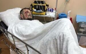 Мосійчук: Ми знайдемо покидьків, які намагалися вбити мене і вбили двох невинних людей