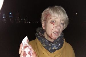 Гольник побили, коли вона поверталася з роботи