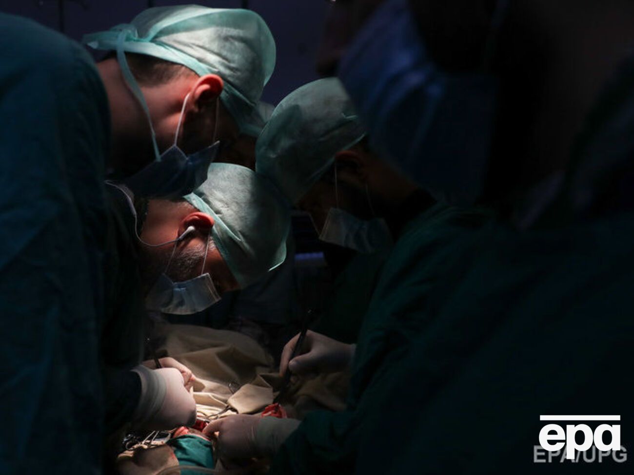 После несчастного случая у француза обгорело 95% кожного покрова