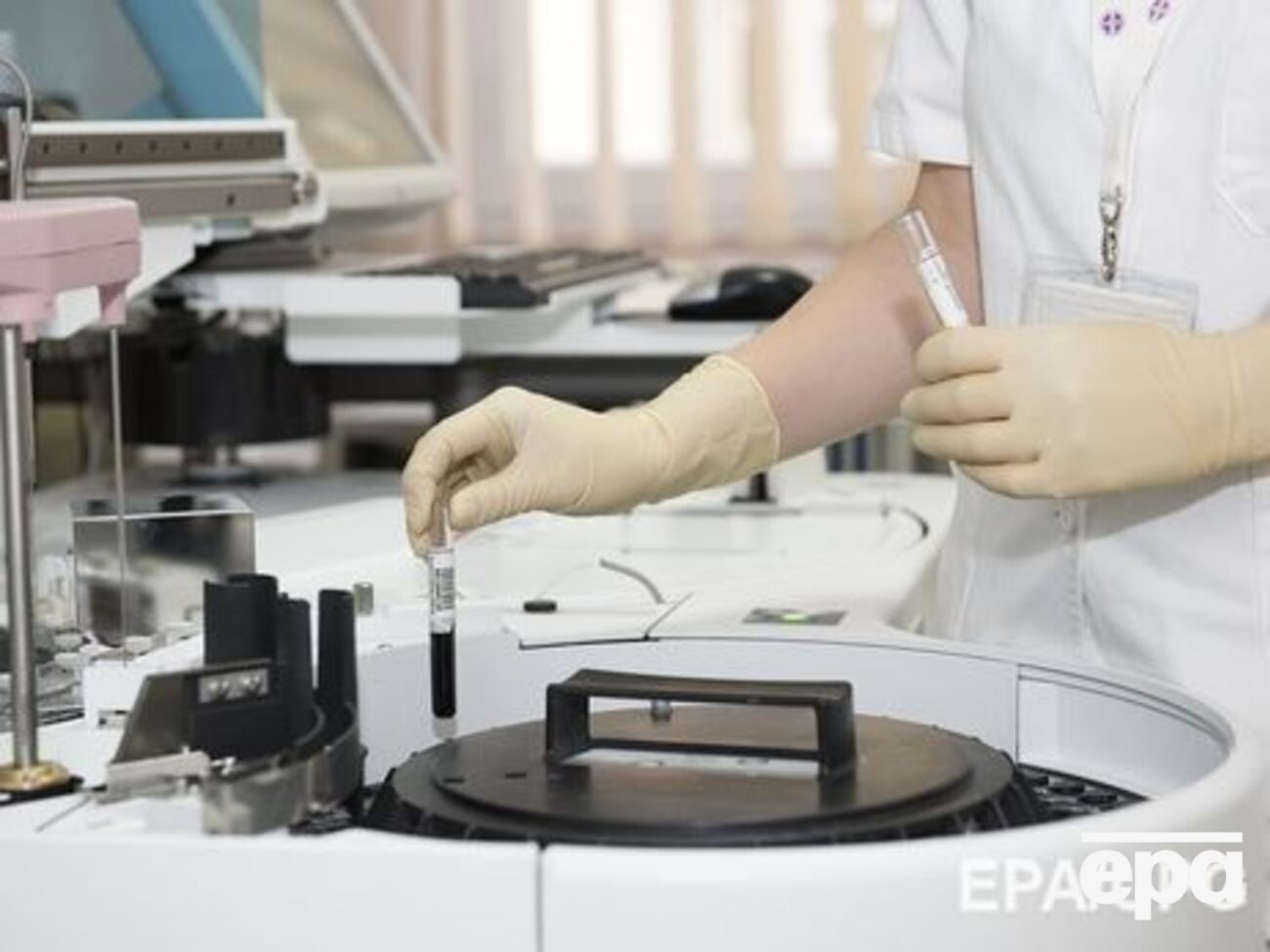 Менингококковая инфекция с молниеносным течением является глобальной мировой проблемой, заявили в КГГА