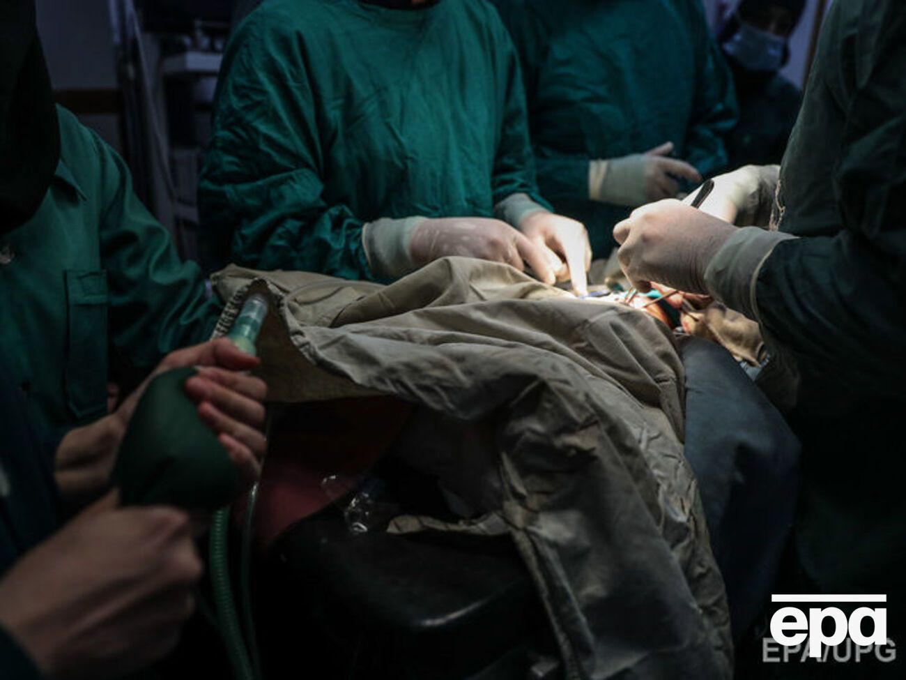 Чоловік переніс складну операцію