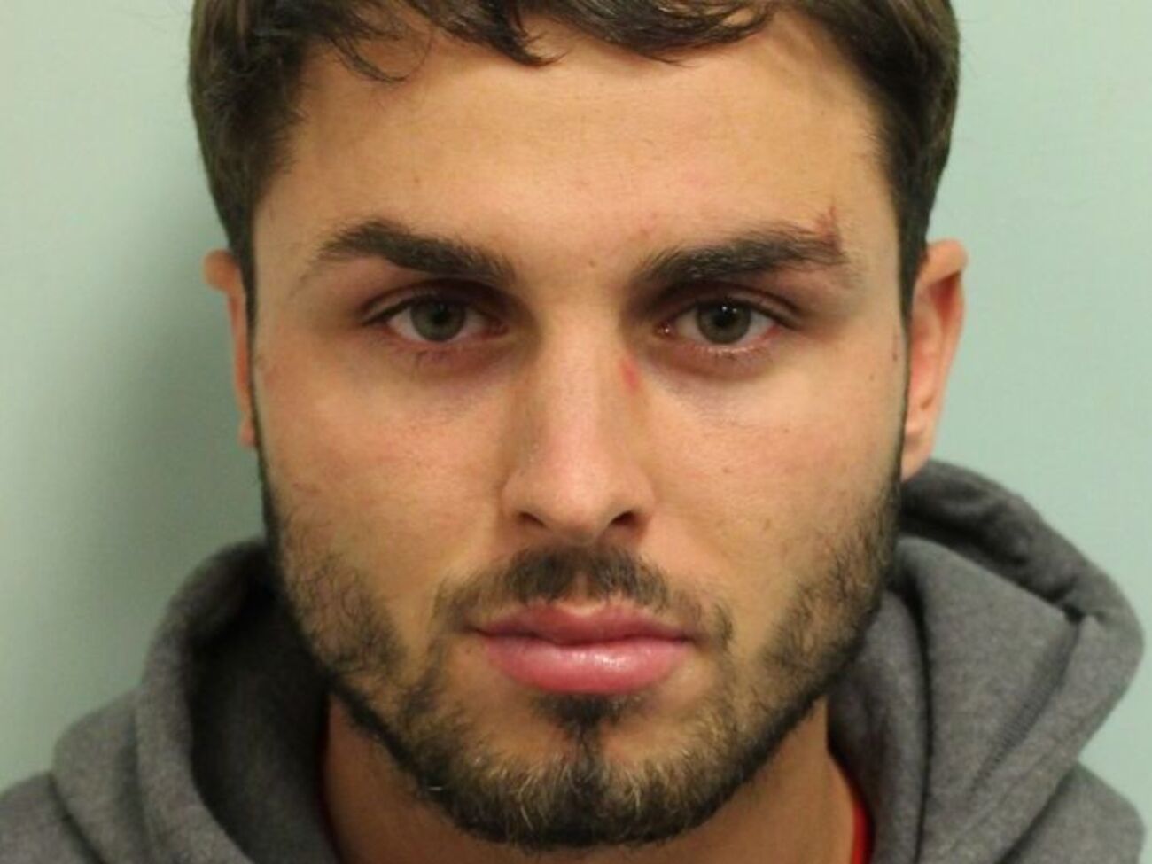 Коллинз разлил кислоту&nbsp;в&nbsp;ночном клубе