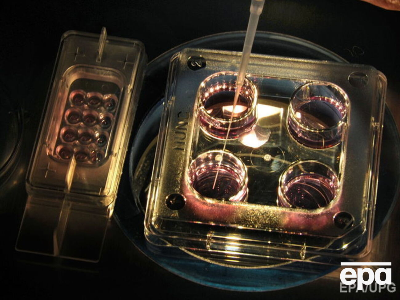 Экстракорпоральное оплодотворение &ndash; технология, используемая в случае мужского или женского бесплодия