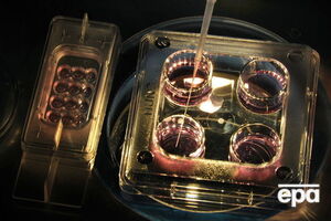 Экстракорпоральное оплодотворение – технология, используемая в случае мужского или женского бесплодия