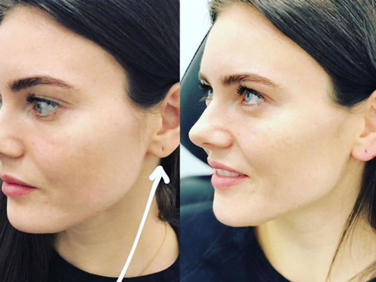 Виктория Крутая:&nbsp;Я всегда сплю в сережках и часто ношу очень тяжелые серьги, поэтому у меня чуть-чуть растянулись уши