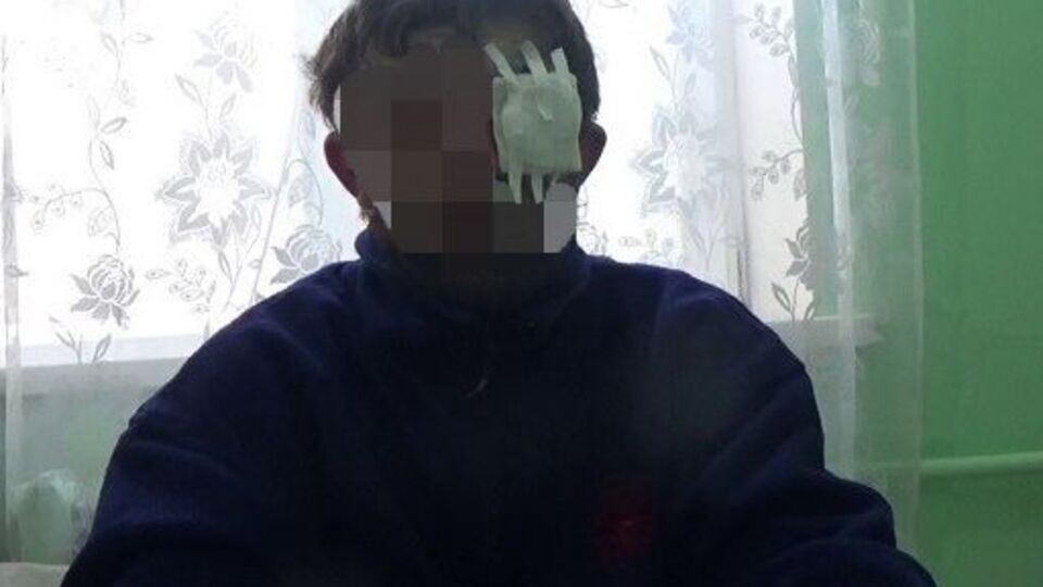 Бойовик на прізвисько Голова розповів про російських інструкторів на Донбасі