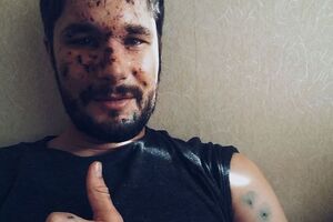 Нанн: Моя цель – убедиться, что я, Вова и семья Елены проходят через все это нормально и с необходимой поддержкой