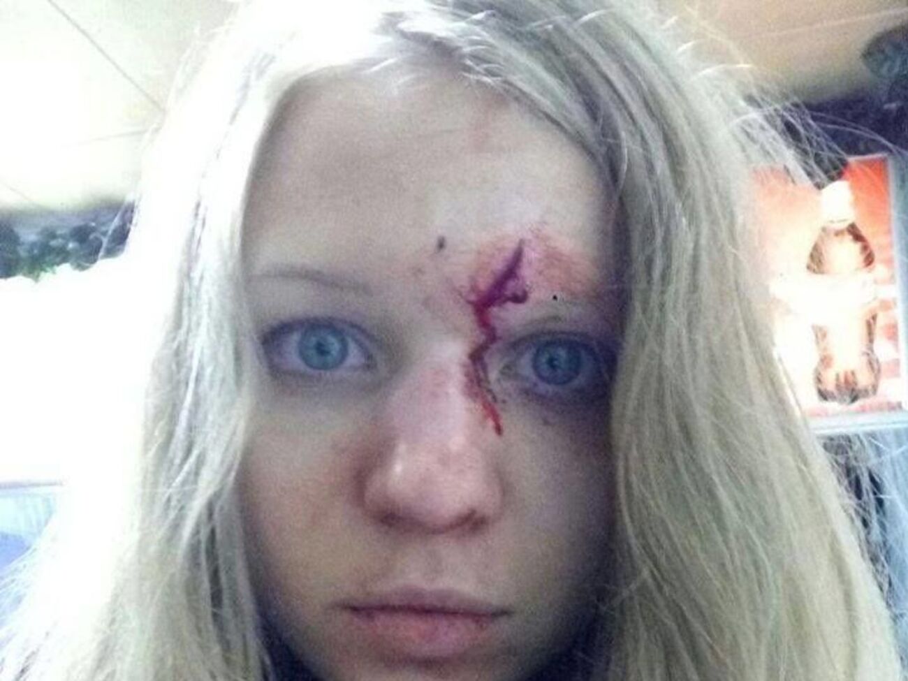 В С14 считают, что Заверуха упала и рассекла лоб