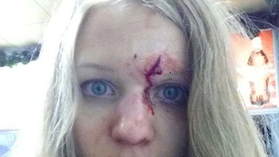 В С14 считают, что Заверуха упала и рассекла лоб