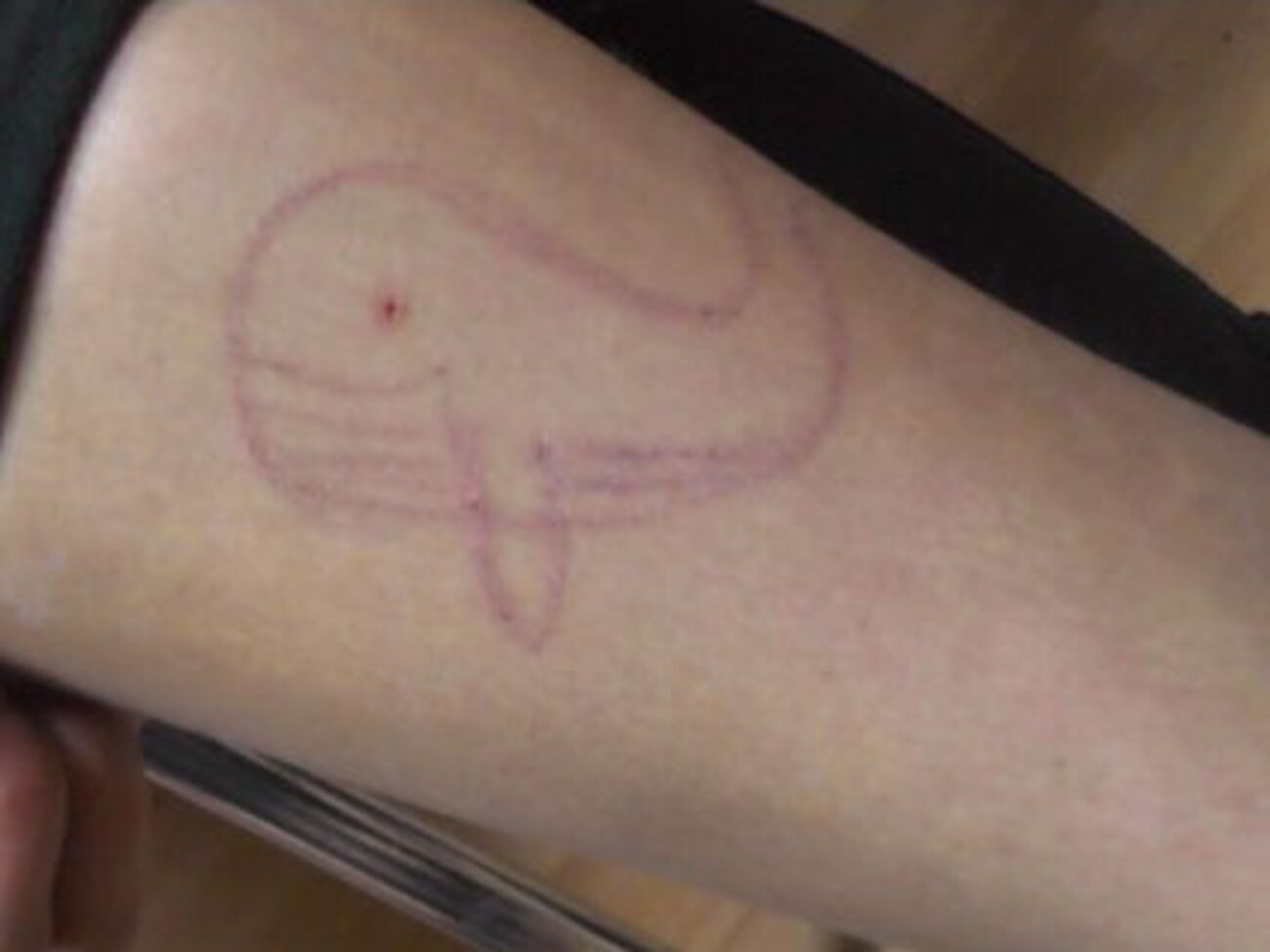 На ногах і руках підлітків виявили порізи, написи та малюнки