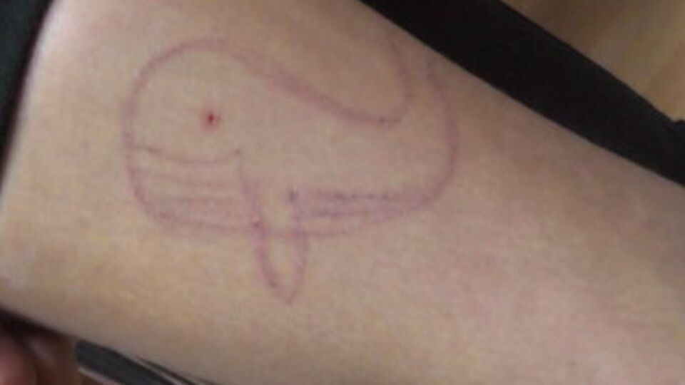 На ногах и руках подростков обнаружили порезы, надписи и рисунки