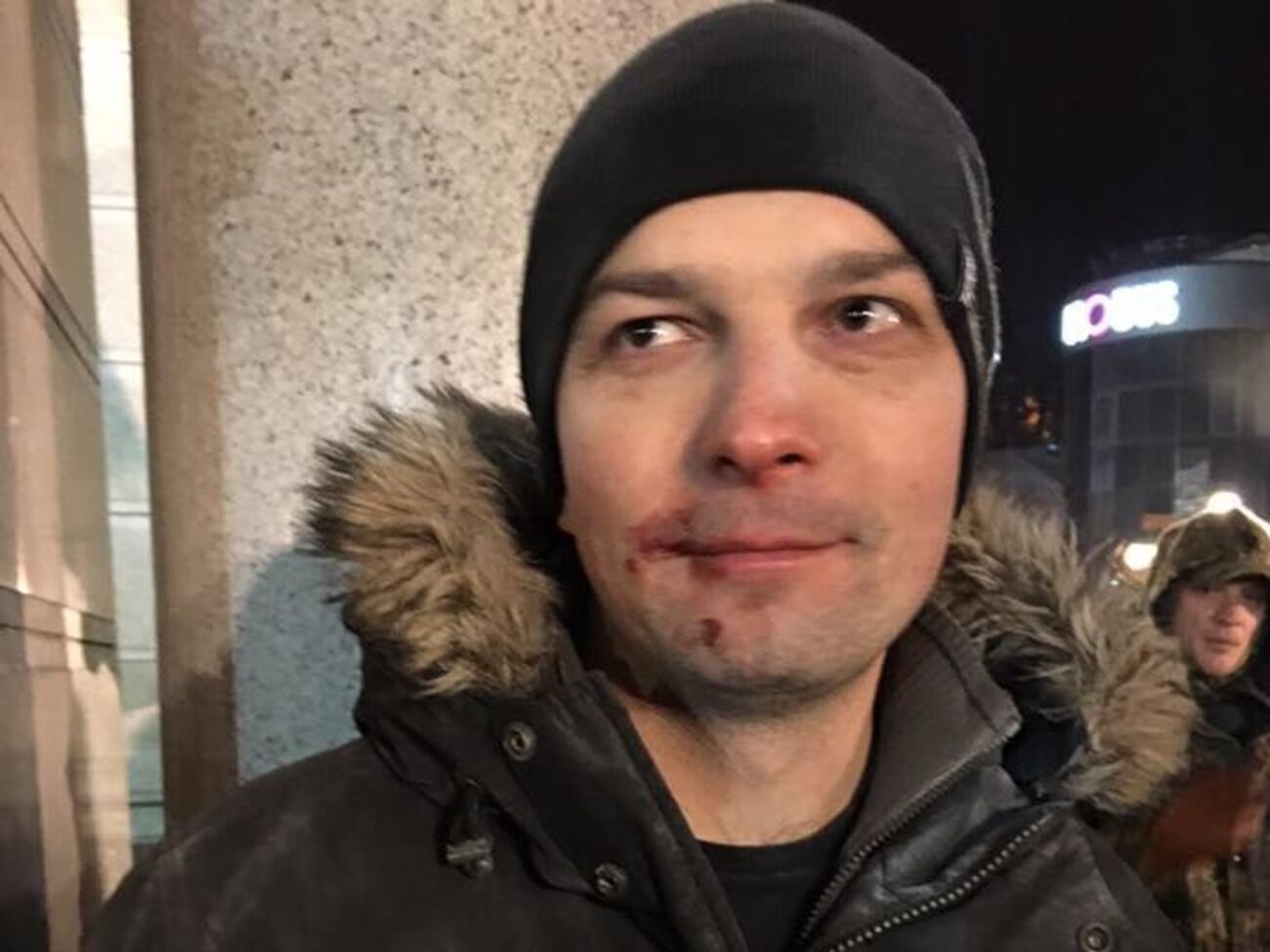 Соболев пострадал в ходе стычек в центре столицы