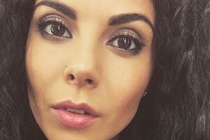 Каменских показала ногу после операции