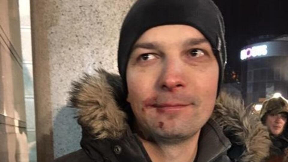 Соболев пострадал в ходе стычек в центре Киева