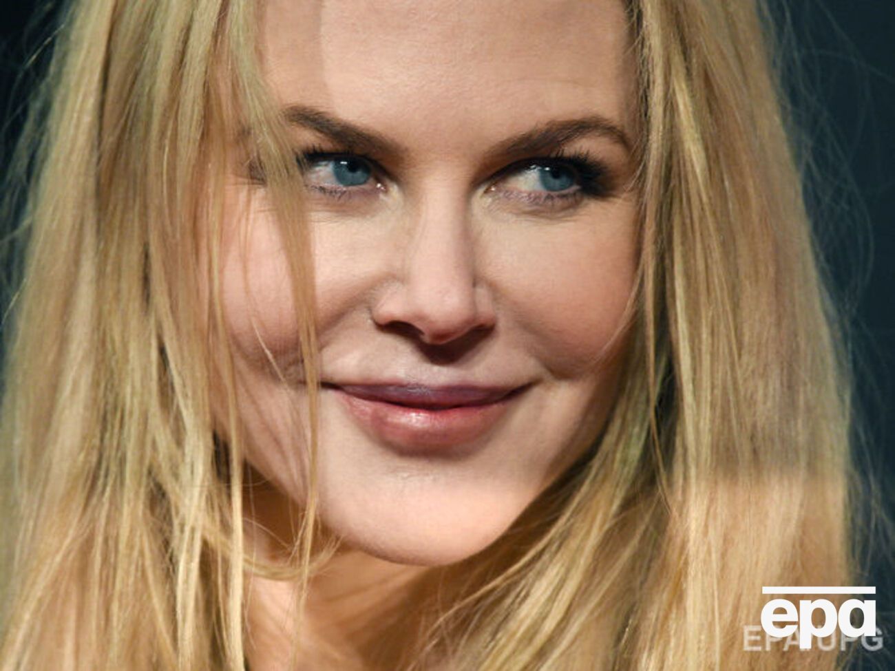 От физической боли Кидман спасалась с помощью лекарств