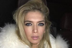 Брежнева: Чтобы было меньше морщин, нужно сделать мимику спокойнее. Но это буду не я. Какое удовольствие не быть собой?