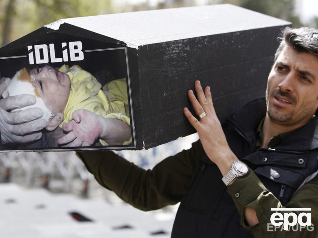 В результате применения в Сирии токсичных веществ погибли более 30 детей