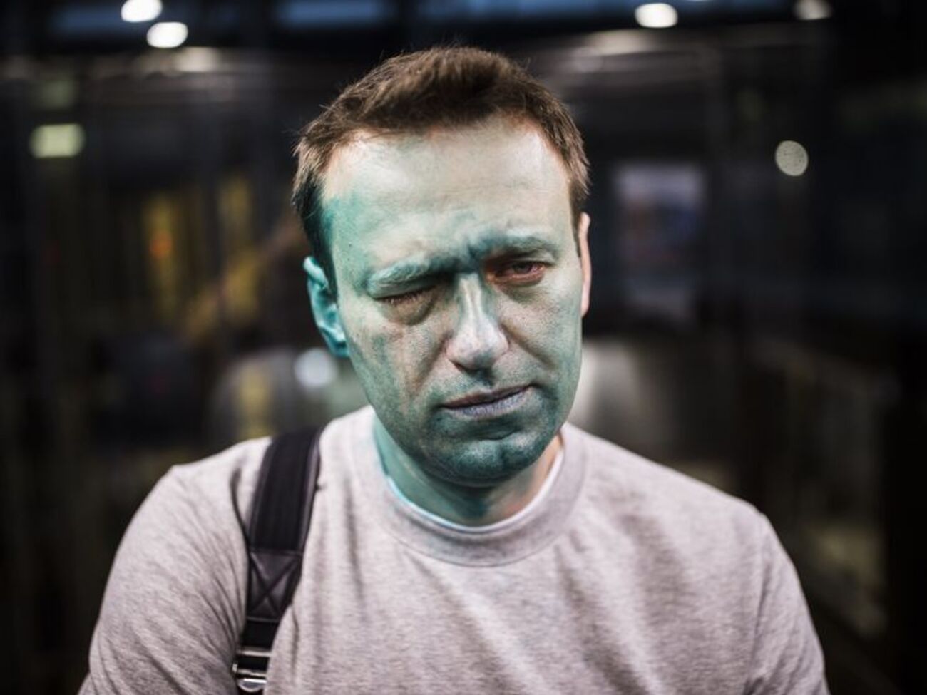 Алексей Навальный после&nbsp;нападения