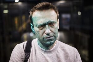 Олексій Навальний після нападу