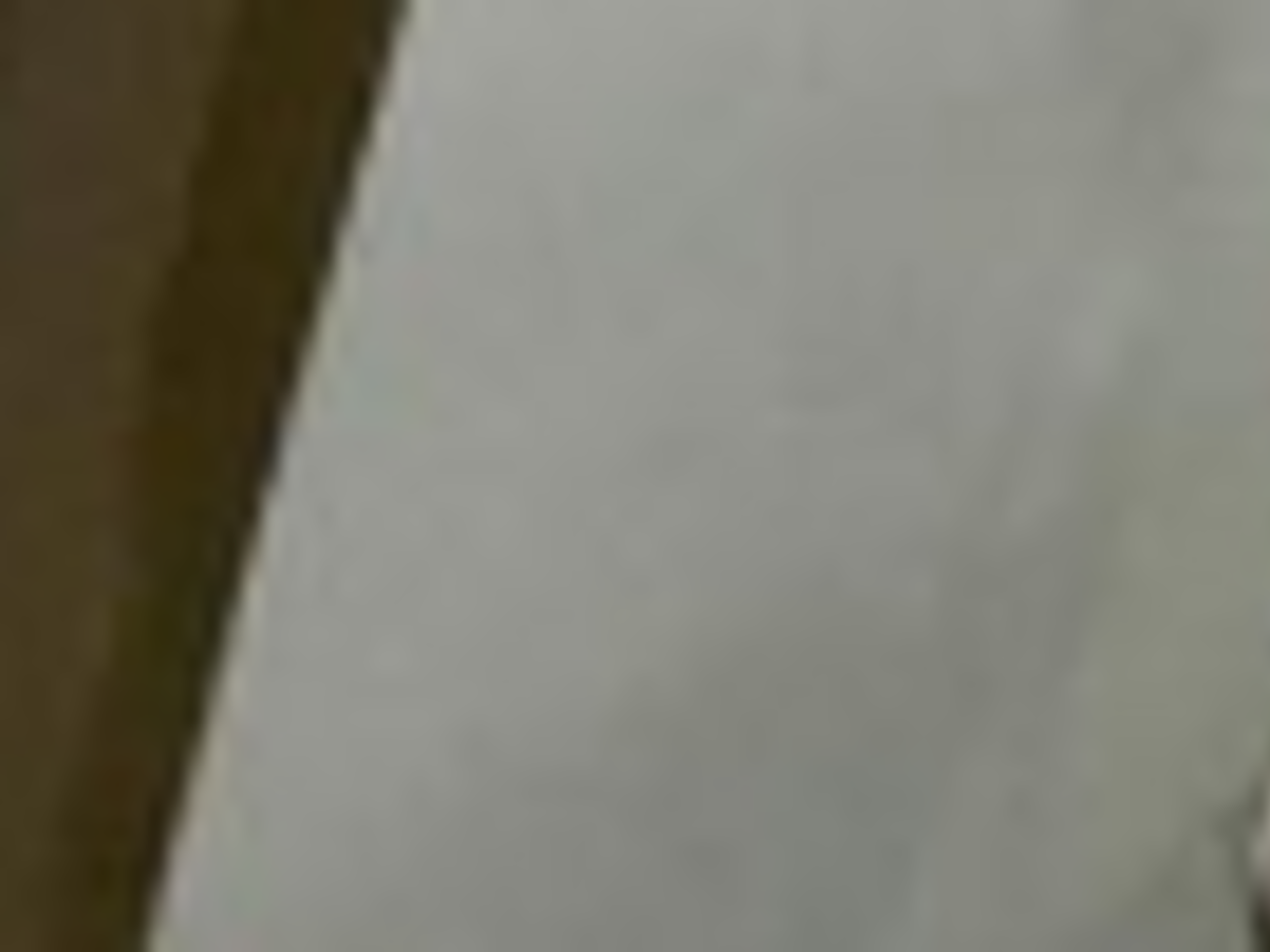 Буйнов страдает от боли из-за повреждения мениска